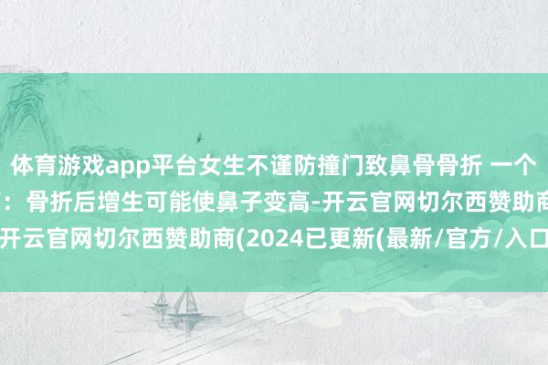 体育游戏app平台女生不谨防撞门致鼻骨骨折 一个月后竟喜升迁鼻梁 医师：骨折后增生可能使鼻子变高-开云官网切尔西赞助商(2024已更新(最新/官方/入口)
